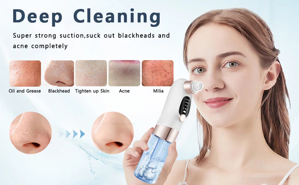 LAQTA blackhead remover tool with stainless steel tips for facial pore cleansing and blackhead extraction.