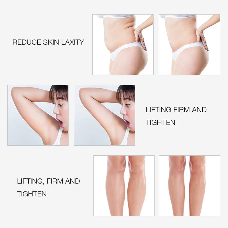 LAQTA EMS and RF radio frequency body slimming machine showing sleek design with control panel and treatment head for body contouring.
