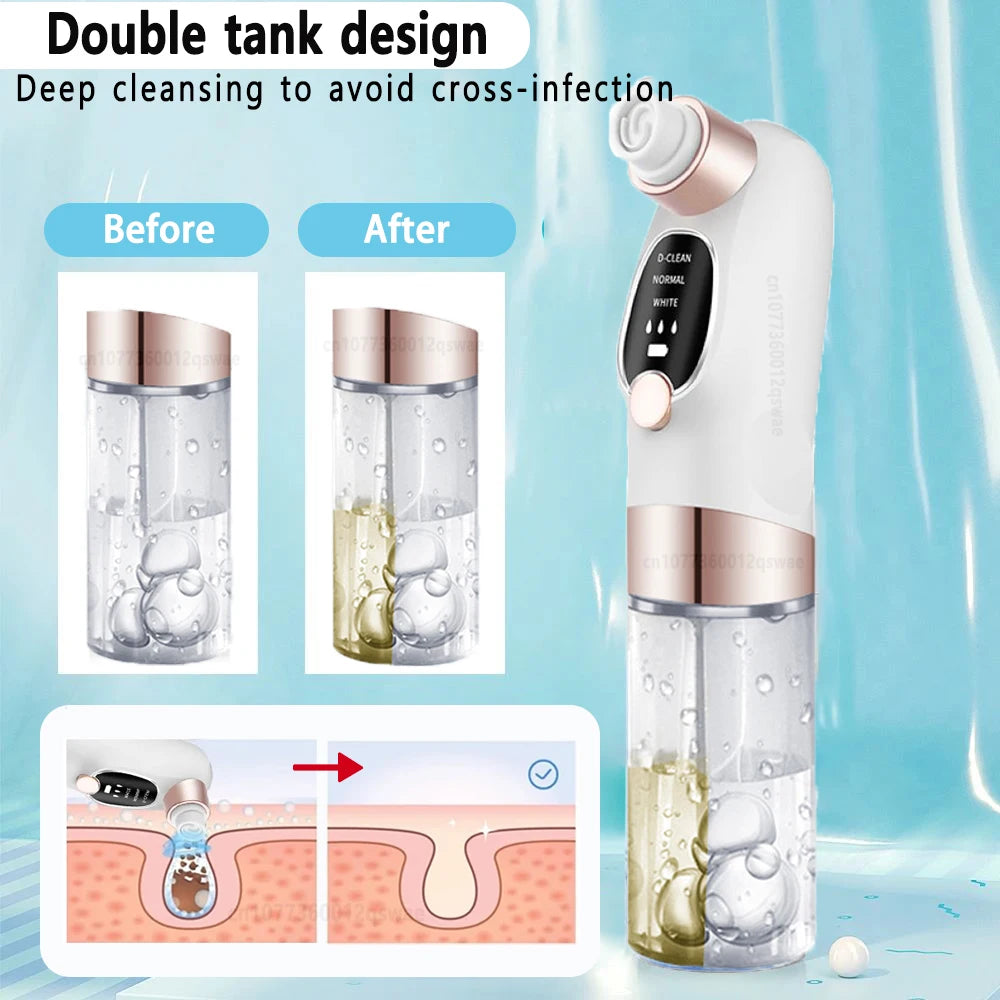 LAQTA blackhead remover tool with precision tips for clear skin, shown on a white background with close-up detail.