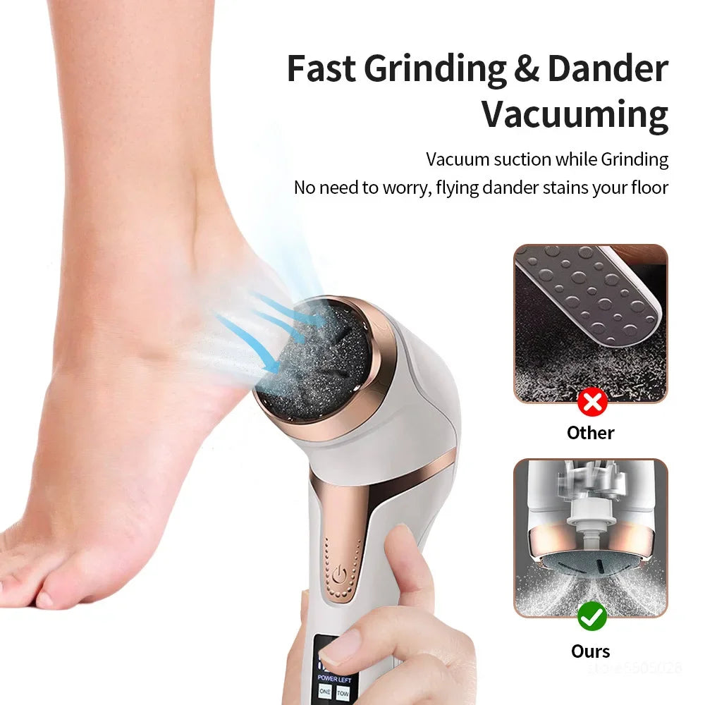 LAQTA electric foot file pedicure machine with a textured roller for smooth, soft feet in a compact handheld design.
