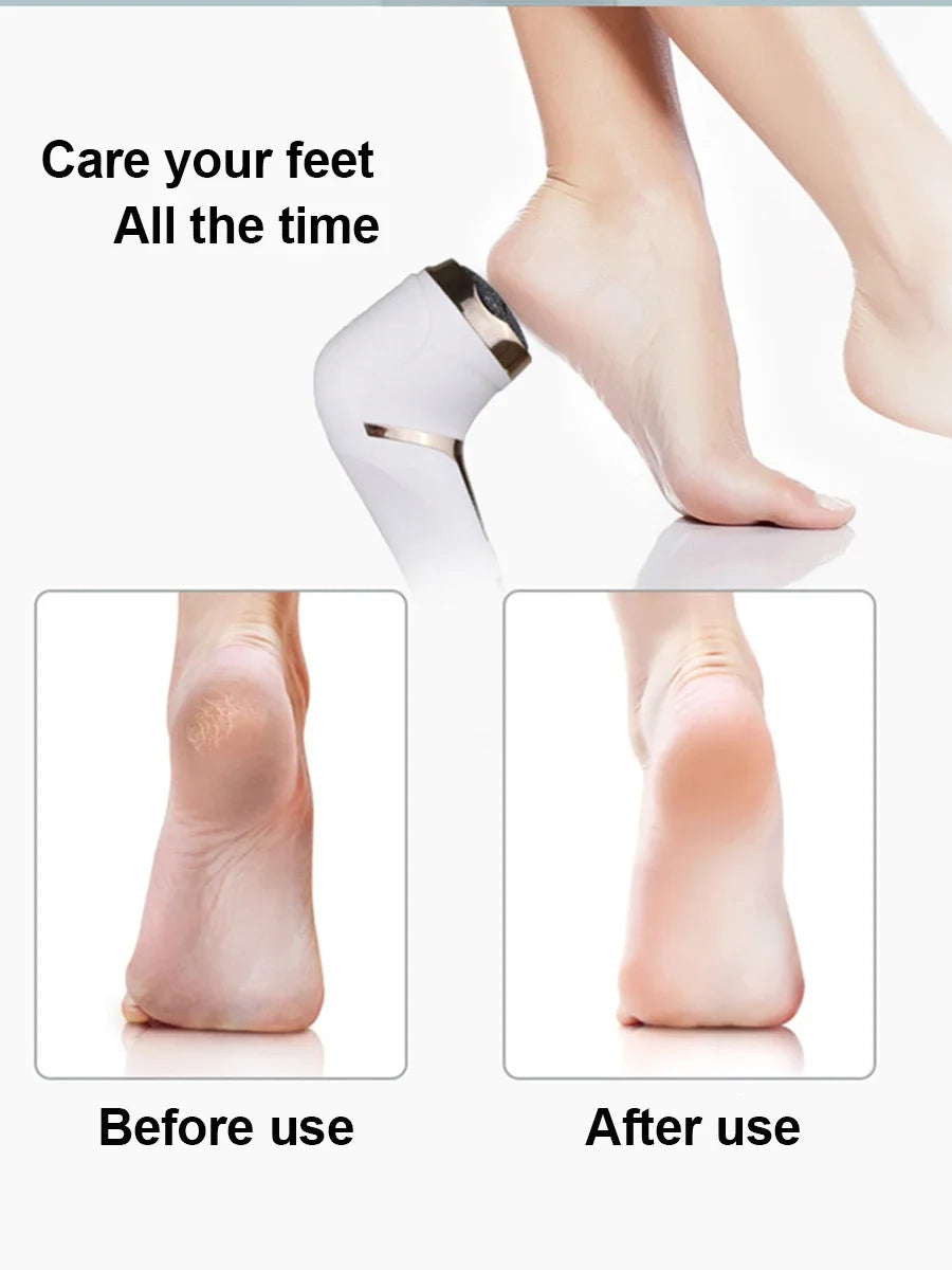 LAQTA Electric Foot File Pedicure Machine with ergonomic handle and replaceable roller for smooth, soft feet.