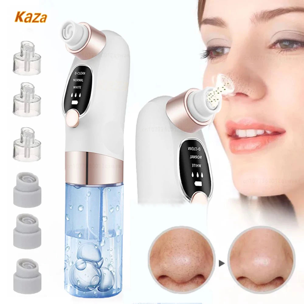 LAQTA blackhead remover tool with precision tips for extracting blackheads and clearing pores on the face.
