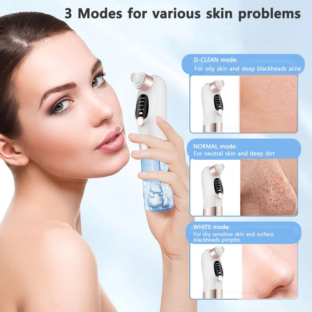 LAQTA blackhead remover tool with precision tip for facial pore extraction and skin cleansing.