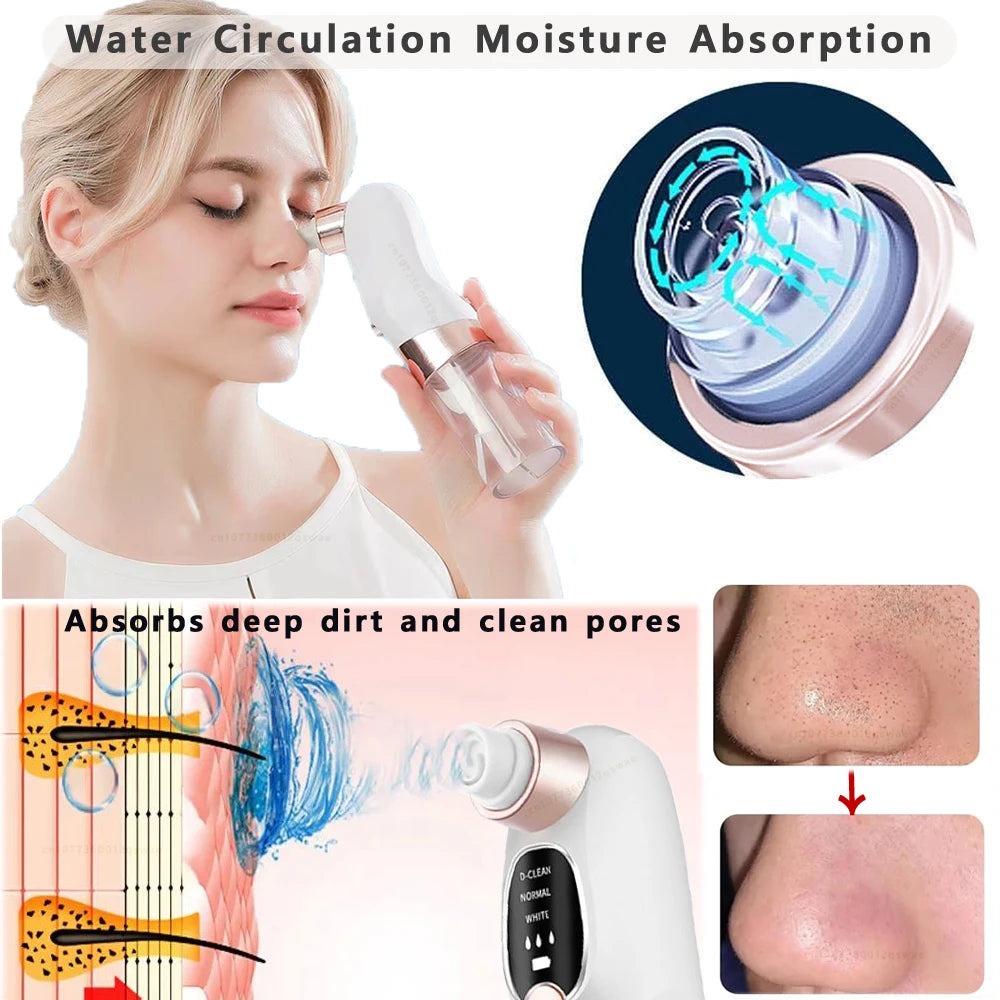 LAQTA blackhead remover tool with stainless steel tip for extracting blackheads and clearing pores on the face.
